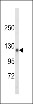 SDCCAG33 Antibody (Center)