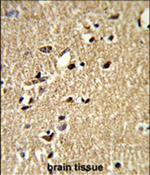 SDCCAG33 Antibody (Center)