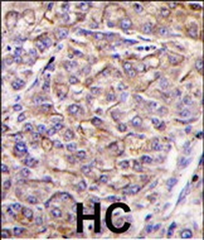 JIK (TAOK3) Antibody (C-term)