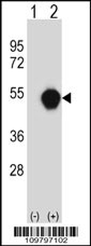 PXK Antibody (Center)