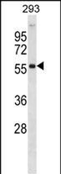 AKT2 Antibody (Center)