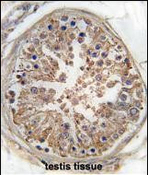 AMPK gamma (PRKAG1) Antibody (Center)