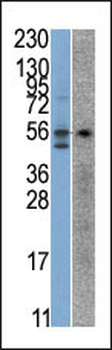 STK38 Antibody (C-term)