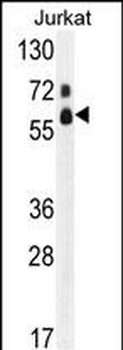 FASTK Antibody (C-term)