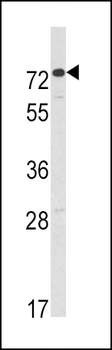 AMHR2 Antibody (C-term)