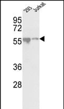 CDKL2 Antibody (Center)