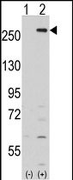 LMTK2 Antibody (Center)
