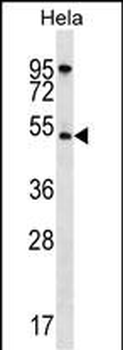 AKT1 Antibody (N-term)