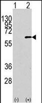 AKT1 Antibody (N-term)