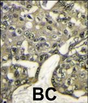 AKT1 Antibody (N-term)