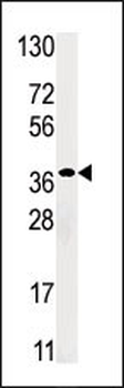 RBKS (RBSK) Antibody (N-term)