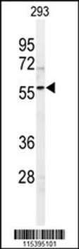 SPHK1 Antibody (C-term R414)
