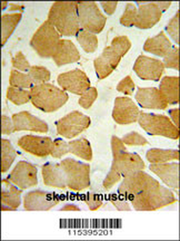 SPHK1 Antibody (C-term R414)