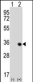 STK16 Antibody (C-term)