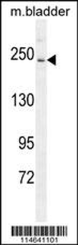 RICTOR Antibody (C-term)