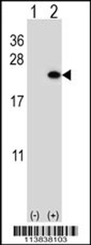 BarX1 Antibody (C-term)
