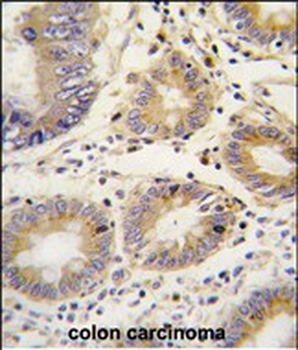 Lefty (LEFTB) Antibody (C-term)