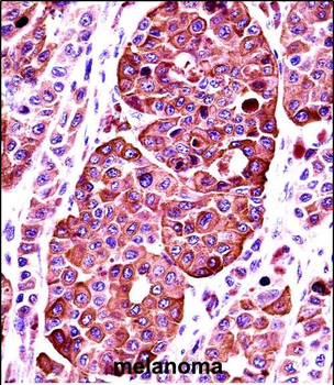 TYR Antibody (Center)