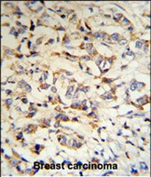 CPN2 Antibody (N-term)