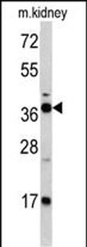 FBP1 Antibody (Center)
