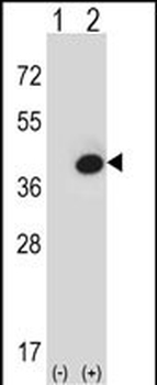FBP1 Antibody (Center)