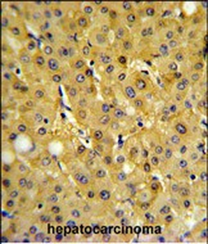 FBP1 Antibody (Center)