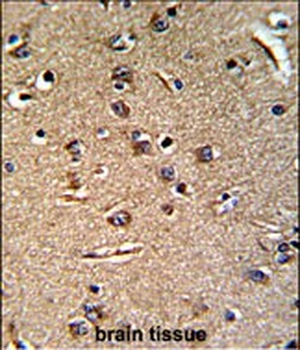 GGTLA1 Antibody (N-term)