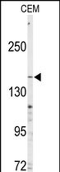 ABCC4 Antibody (C-term)
