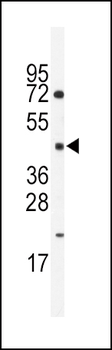 HNF4G Antibody (Center)