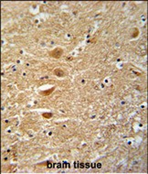 KIF3C Antibody (C-term)