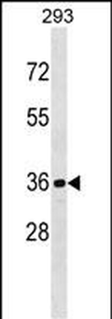 CDKL1 Antibody (C-term)