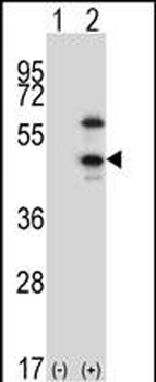 CDKL1 Antibody (C-term)