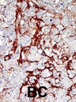 CDKL1 Antibody (C-term)