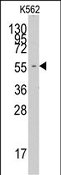 FARSA Antibody (N-term)