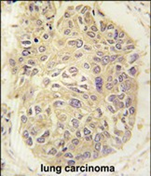 FARSA Antibody (N-term)