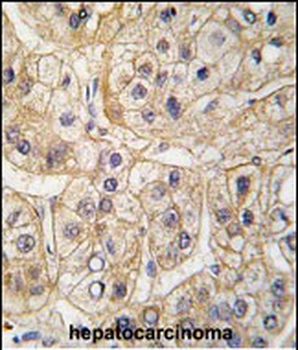 EGFR Antibody (S1070)