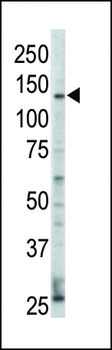 ERBB4 Antibody(N-term)