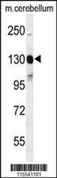 KIT Antibody (Y703)
