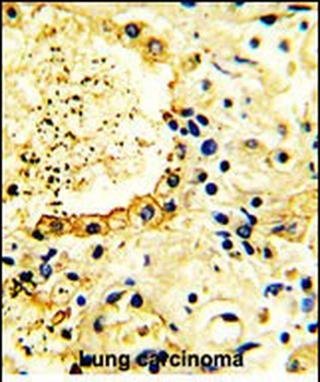 ACK1 Antibody (N-term)