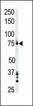 BTK Antibody (Center)