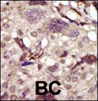 BTK Antibody (Center)
