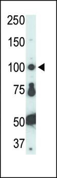 FER Antibody (C-term)