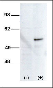 STK38L Antibody (C-term)