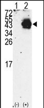 PDX1 Antibody (N-term)