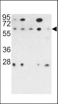 PR48 Antibody (N-term)