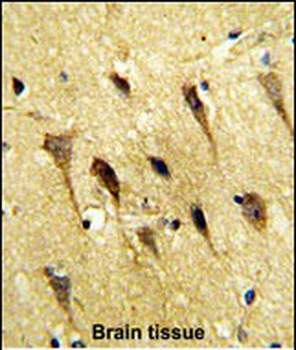 WBP2 Antibody (C-term)