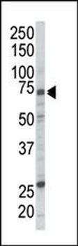 RAF1 Antibody (N-term)