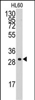 Cyclin C (CCNC) Antibody (C-term)