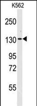 VARS Antibody (N-term)