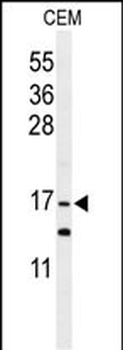 GMFG Antibody (C-term)
